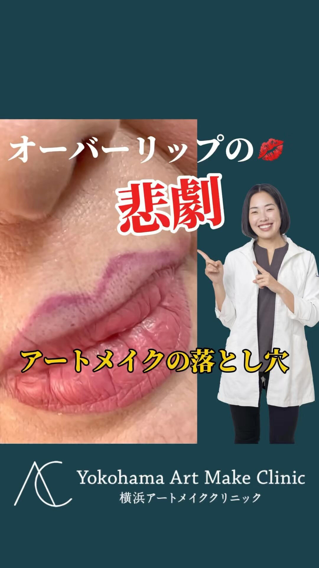 アート メイク 唇 失敗